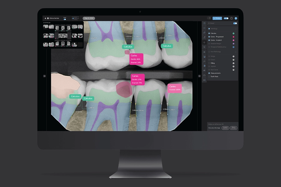 AI-powered precision at Bella Dentaire